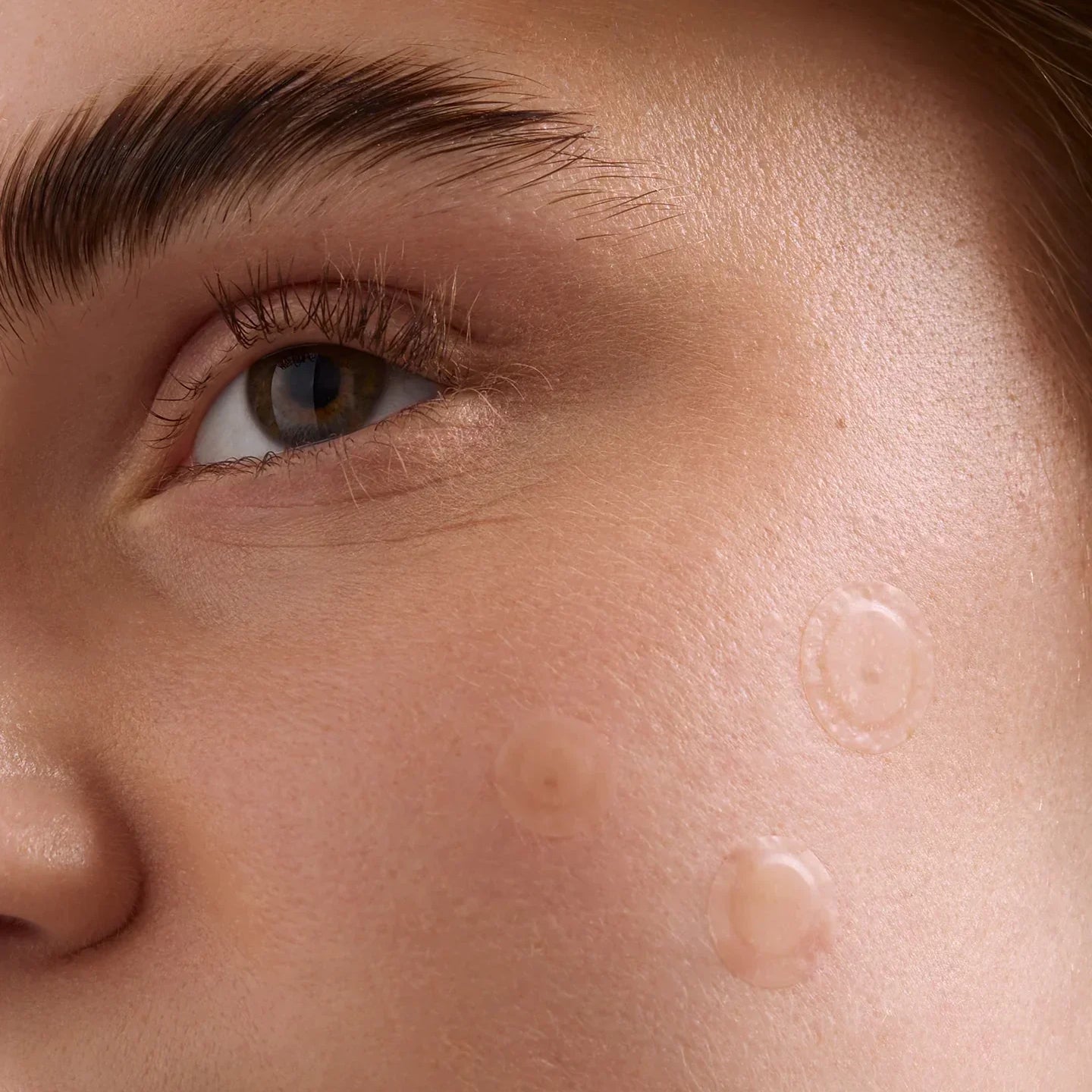 Why Are People Wearing Stylized Pimple Patches?